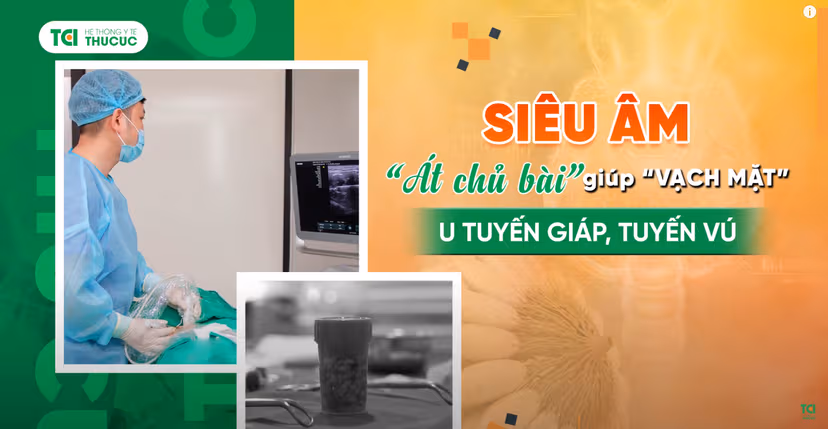 Siêu âm : Át chủ bài trong chẩn đoán và điều trị u tuyến giáp, tuyến vú