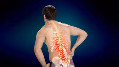 Giải đáp: Có nên mổ thoát vị đĩa đệm không