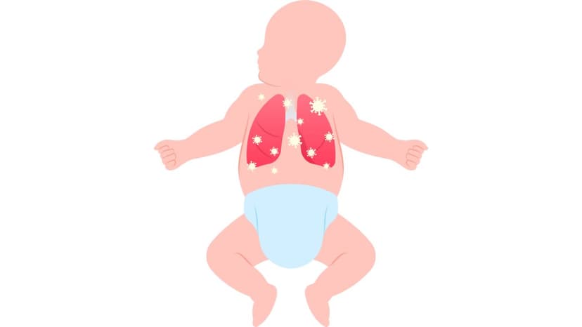 Trẻ sơ sinh viêm phổi: Nhận biết sớm để điều trị kịp thời