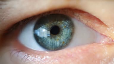 Phẫu thuật sụp mí mắt: Giới thiệu 4 phương pháp phổ biến nhất