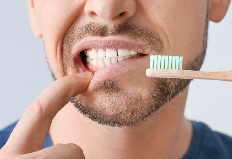 thuốc đặc trị viêm lợi chảy máu chân răng tại TCI