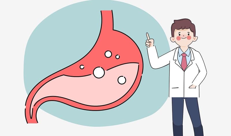 Trào ngược dạ dày - thực quản là bệnh gì?