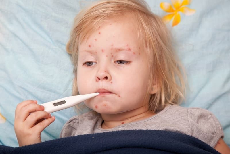 Khi bị biến chứng do thủy đậu, trẻ sẽ sốt cao liên tục