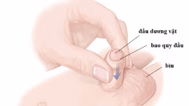 Những lợi ích cắt bao quy đầu mà bạn nên biết