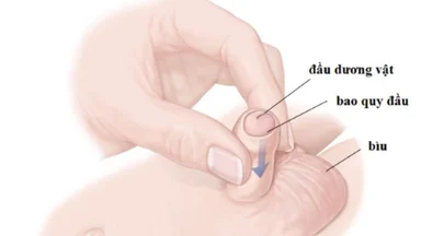 Những lợi ích cắt bao quy đầu mà bạn nên biết