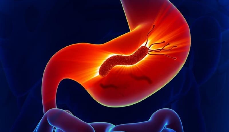 Cơ chế vi khuẩn HP gây trào ngược dạ dày là gì?