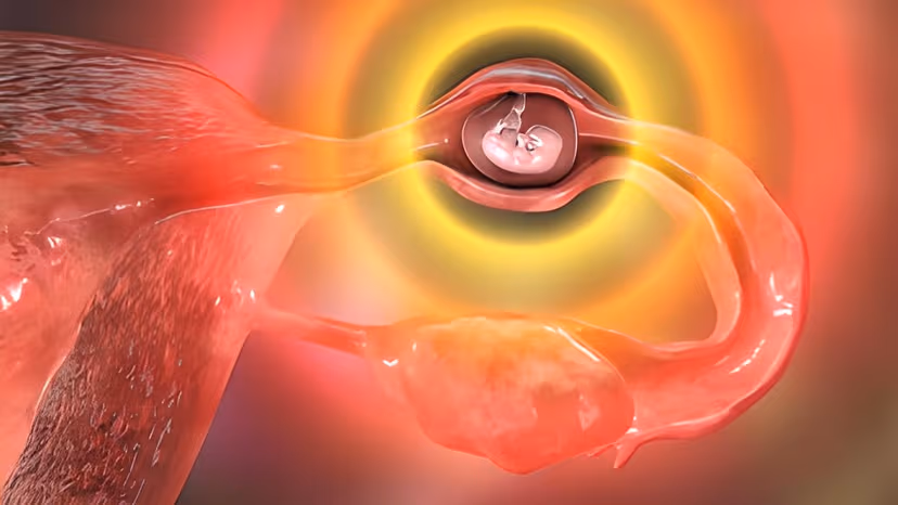 Chửa ngoài tử cung nguy hiểm thế nào và cách nhận biết sớm
