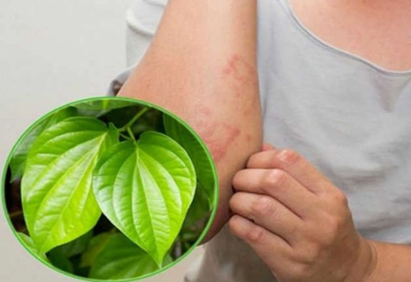 cẩn trọng với mẹo chữa u bã đậu bằng lá trầu không