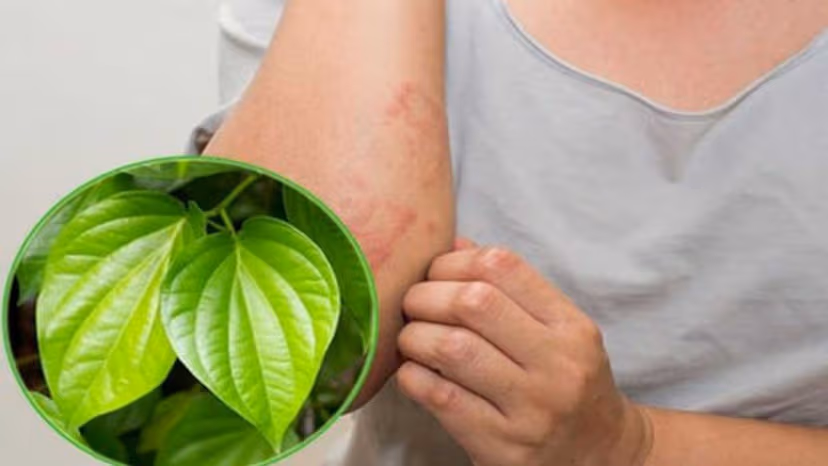 Cẩn trọng trước các mẹo chữa u bã đậu từ dân gian