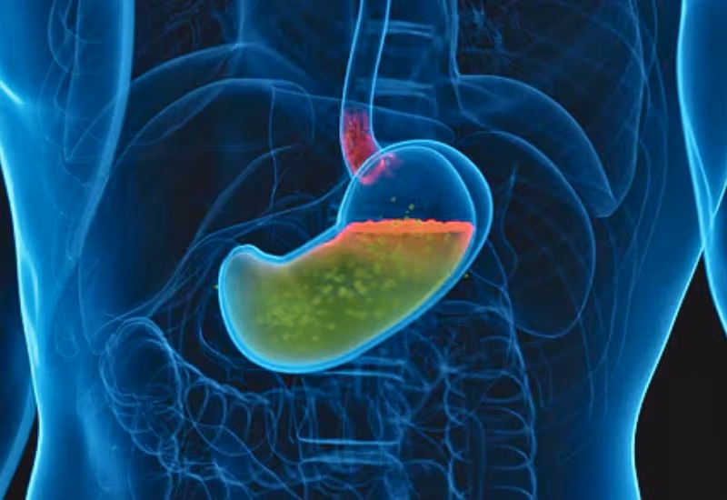 Mối liên hệ giữa ợ chua, ợ nóng và các bệnh lý dạ dày