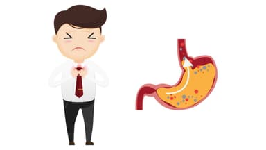 Nên làm gì khi bị ợ chua – Khuyến cáo từ chuyên gia