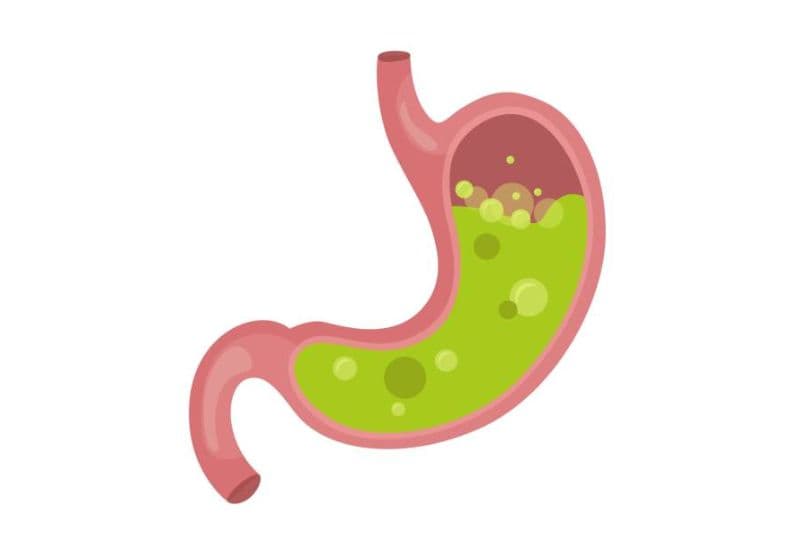 Các bệnh lý tiêu hóa liên quan đến triệu chứng ợ hơi nhiều