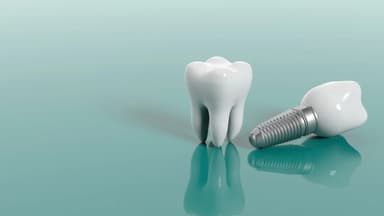 Tư vấn trồng răng implant cho người già: Nên hay không