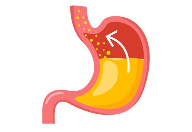 Nguyên nhân gây ra tình trạng ợ hơi nhiều, không dứt