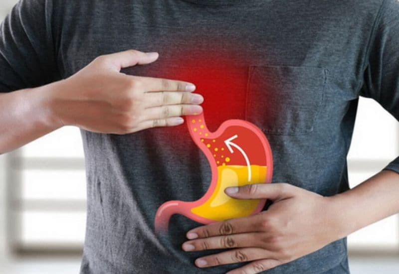 Mối liên hệ giữa ợ nóng rát cổ họng, ho kéo dài và GERD