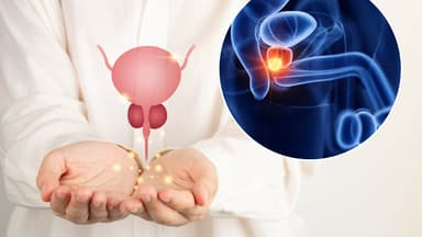Nam giới không nên bỏ qua việc tầm soát ung thư tiền liệt tuyến
