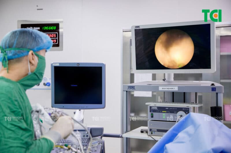 Phương pháp phòng ngừa ứ nước thận do sỏi