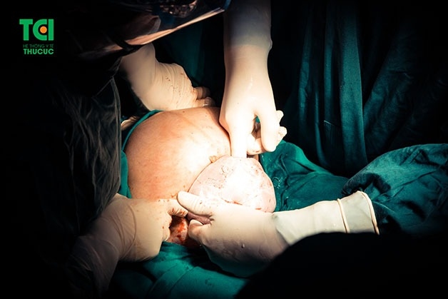 Chăm sóc sản phụ sau đẻ mổ cần chú ý tới vết mổ để cơ thể mẹ sớm bình phục và ổn định