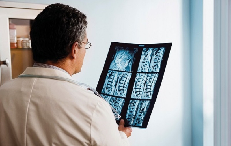 Chụp MRI cột sống thắt lưng