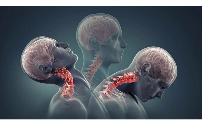 Bệnh lý về cổ được phát hiện thông qua kỹ thuật MRI