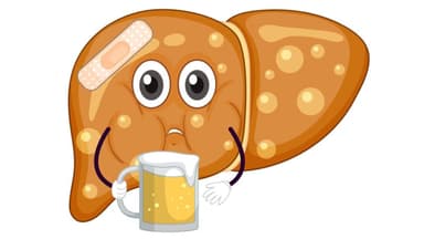 Tổng hợp cách điều trị viêm gan do rượu và những lưu ý