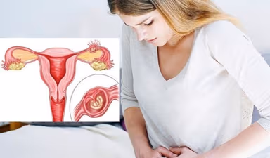 Phòng ngừa mang thai ngoài tử cung: Mẹ cần lưu ý điều gì?