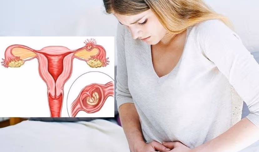 Phòng ngừa mang thai ngoài tử cung: Mẹ cần lưu ý điều gì?