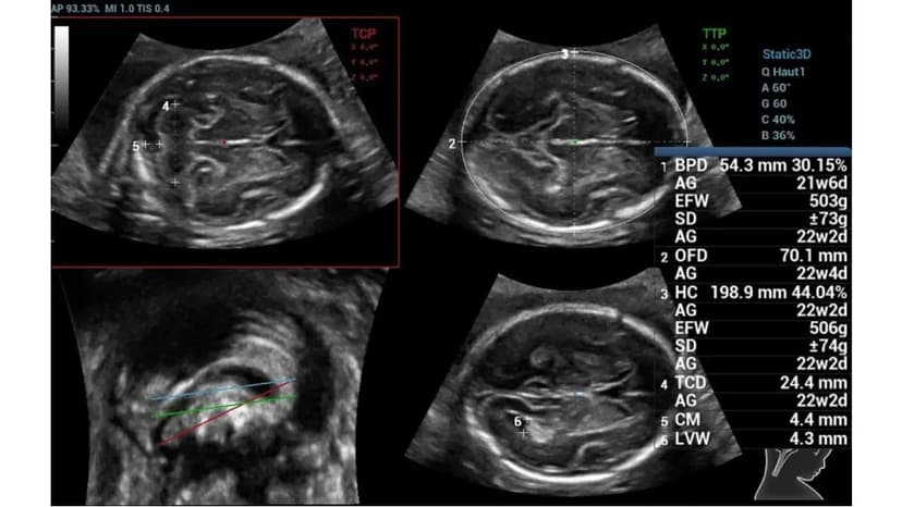 Máy siêu âm Doppler là gì và vai trò của siêu âm Doppler