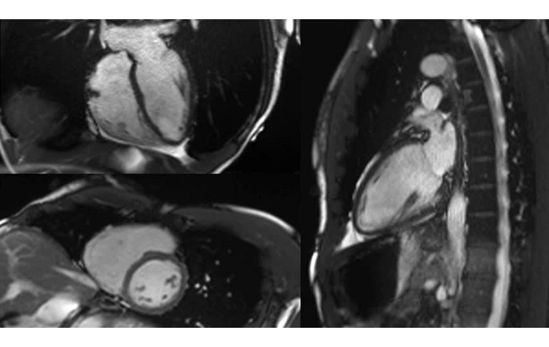 hình MRI tim mạch