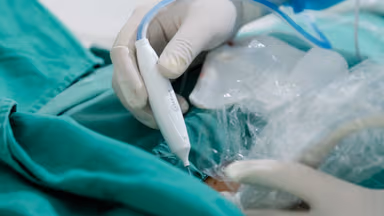 Phẫu thuật u tuyến giáp lành tính bằng đốt sóng cao tần RFA