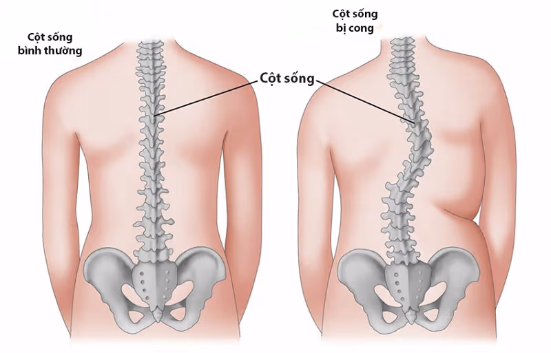 chi phí chụp mri cột sống