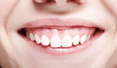 Những phương pháp trị cười hở lợi hiệu quả hiện nay