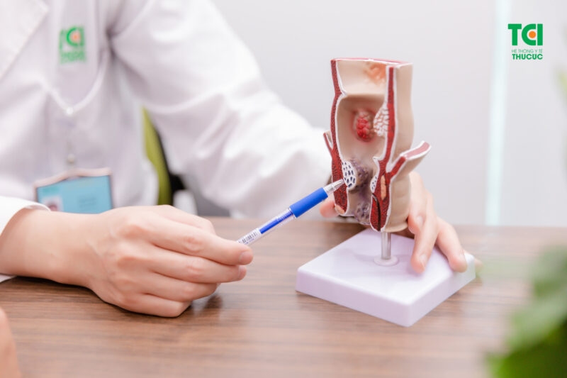 Bệnh trĩ nội có gây đau bụng không