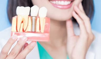 Hướng dẫn chăm sóc răng miệng sau khi trồng răng giả