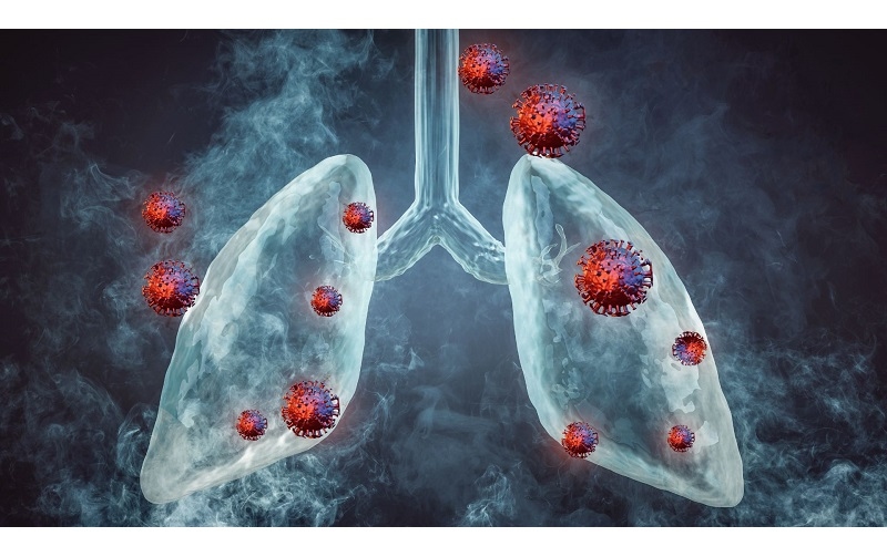 bệnh áp xe phổi