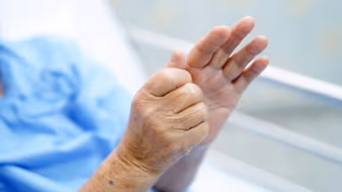 Bệnh Parkinson biểu hiện như thế nào và cách chẩn đoán, điều trị