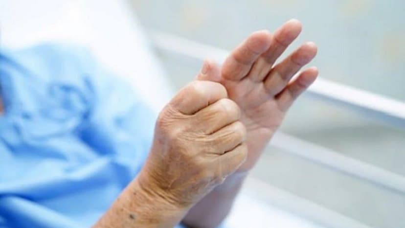 Bệnh Parkinson biểu hiện như thế nào và cách chẩn đoán, điều trị