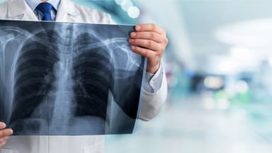 Biểu hiện của viêm phế quản cấp là gì và cách điều trị hiệu quả