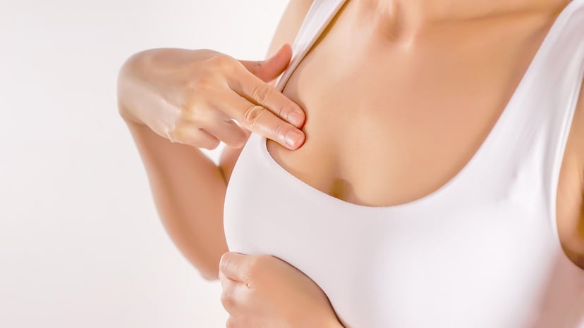 Đừng chủ quan với 4 triệu chứng báo hiệu ung thư tuyến vú