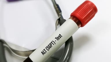 Mối liên hệ giữa men gan cao và gan nhiễm mỡ