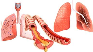 Phân tích COPD là bệnh gì và phương pháp phòng ngừa hiệu quả