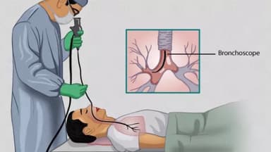 8 Phương pháp chẩn đoán bệnh giãn phế quản hiệu quả