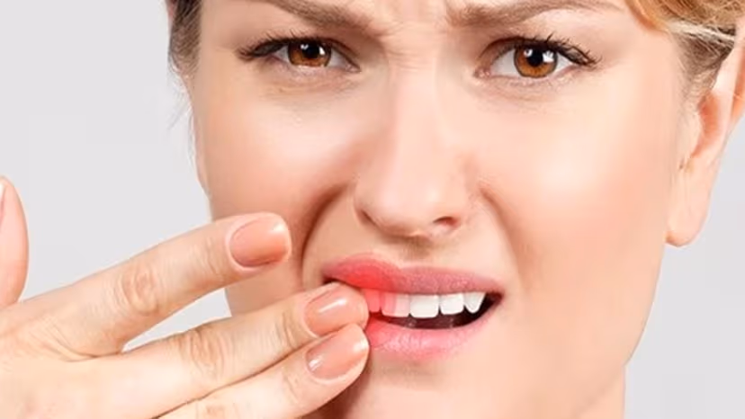 Răng lung lay có giữ được không – giải đáp cụ thể