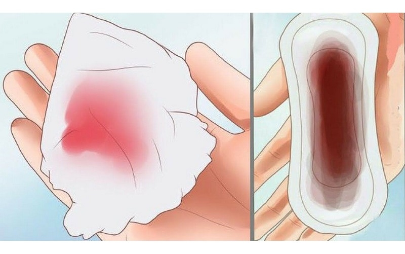 Chảy máu âm đạo bất thường có thể là dấu hiệu cảnh báo sớm tình trạng tổn thương ở cổ tử cung