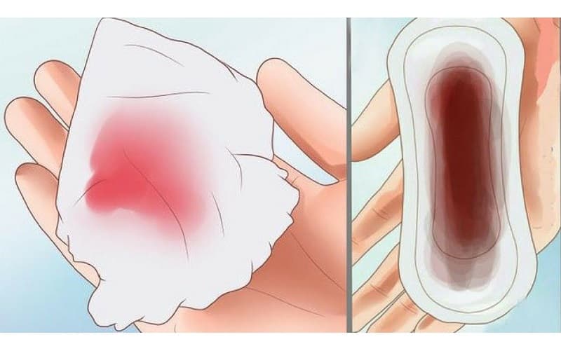 Chảy máu âm đạo bất thường có thể là dấu hiệu cảnh báo sớm tình trạng tổn thương ở cổ tử cung