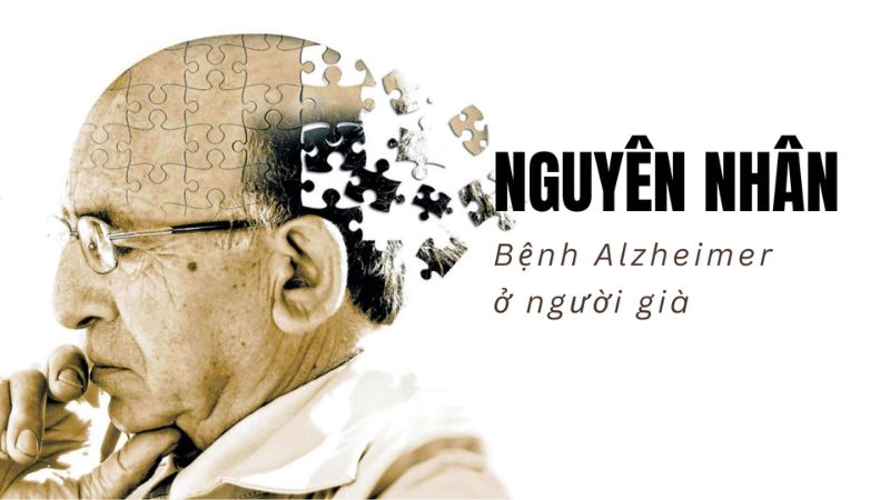 Bệnh Alzheimer nguyên nhân do đâu?