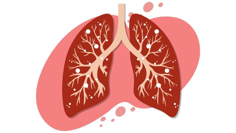 Biến chứng viêm tụy cấp có thẻ gây ra