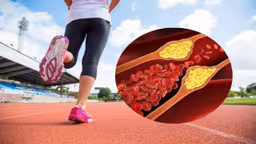 Các bài tập được khuyến cáo cho người bị mỡ máu cao