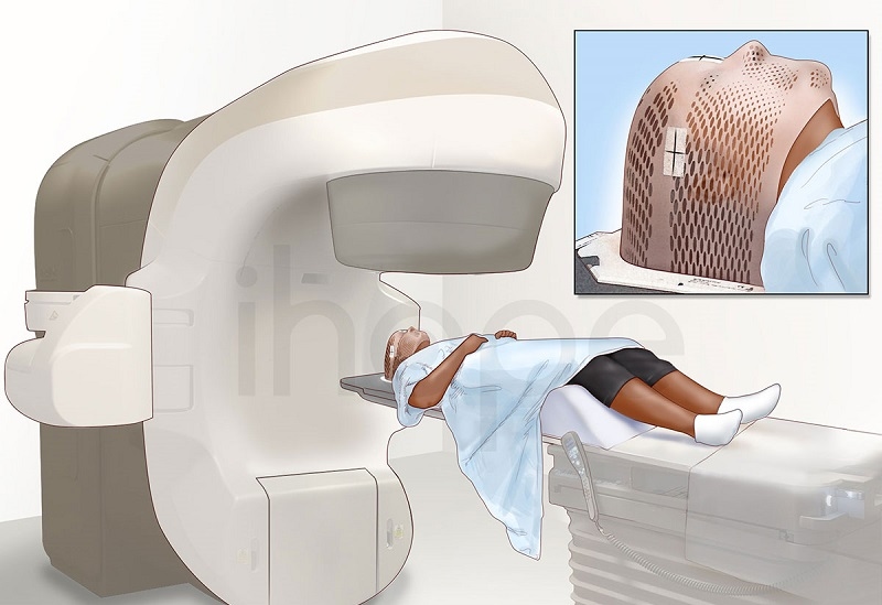 Cách điều trị bệnh ung thư máu