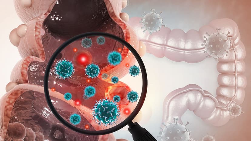 Phương pháp điều trị ung thư trực tràng giai đoạn 2 phù hợp